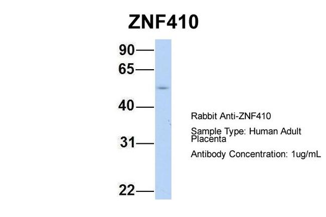 ZNF410 Antibody in Western Blot (WB)
