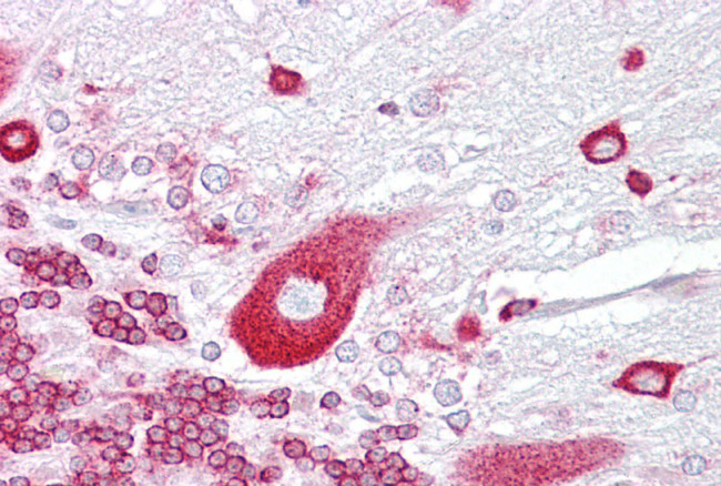 PURA Antibody in Immunohistochemistry (IHC)