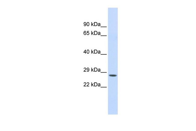 Chymotrypsin Antibody in Western Blot (WB)