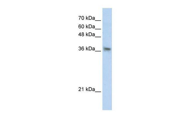 PHYHIP Antibody in Western Blot (WB)