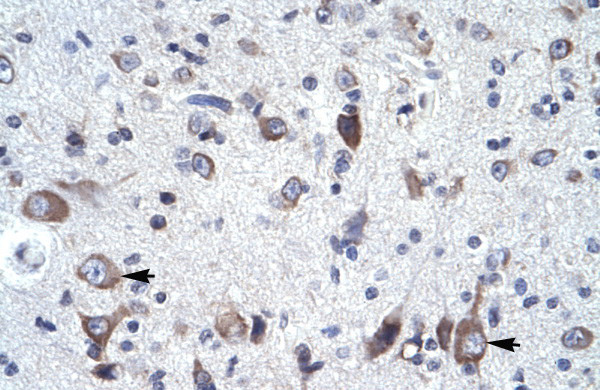 NCS1 Antibody in Immunohistochemistry (IHC)