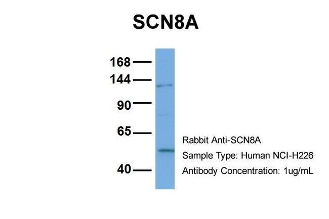 SCN8A Antibody in Western Blot (WB)