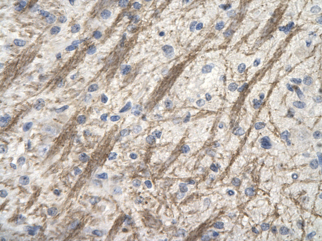 ZNF74 Antibody in Immunohistochemistry (Paraffin) (IHC (P))