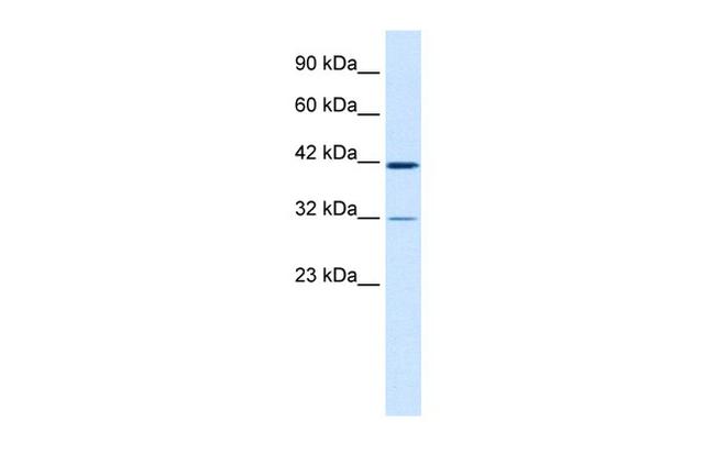 CHST4 Antibody in Western Blot (WB)