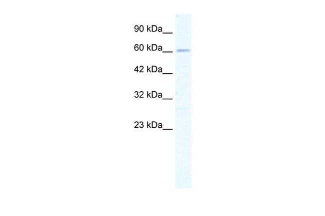 ZNF79 Antibody in Western Blot (WB)