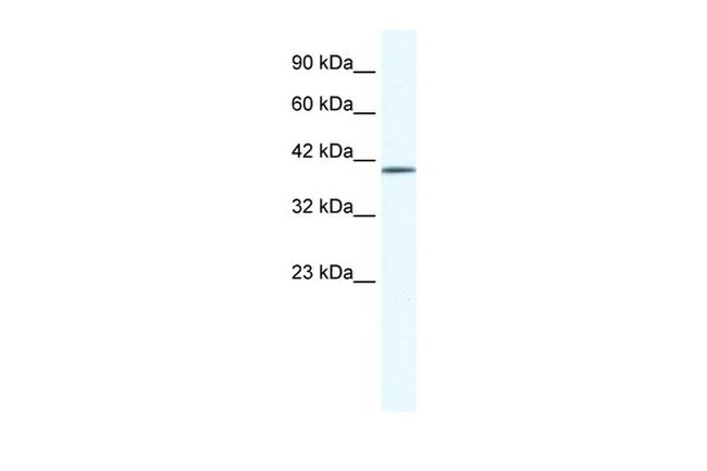 ZNF322A Antibody in Western Blot (WB)