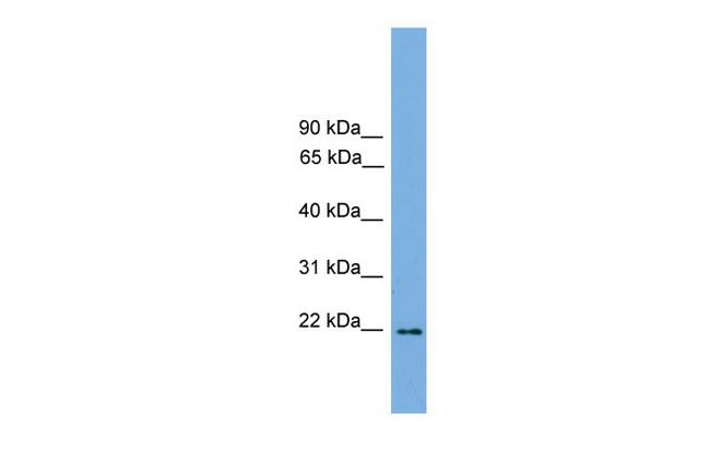 JDP2 Antibody in Western Blot (WB)