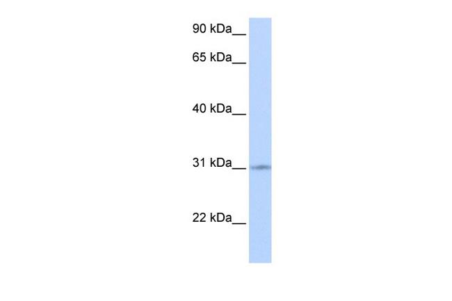 ZNF146 Antibody in Western Blot (WB)