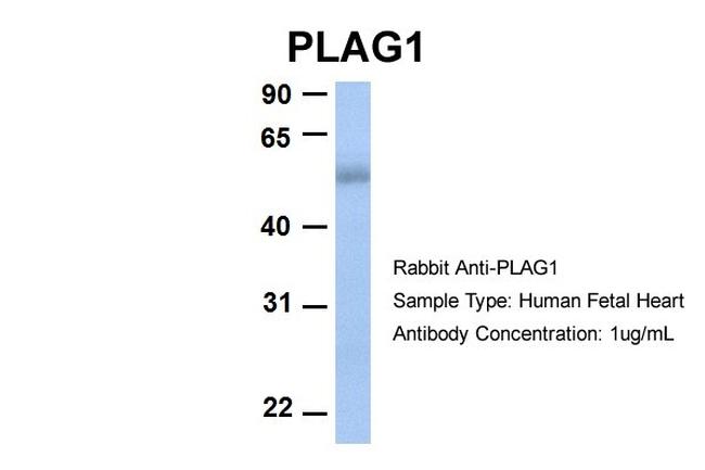 PLAG1 Antibody in Western Blot (WB)