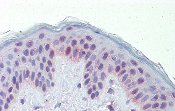 TR2 Antibody in Immunohistochemistry (IHC)