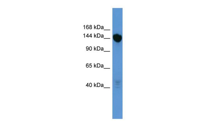 BNC2 Antibody in Western Blot (WB)