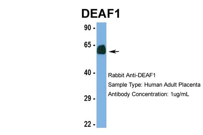 DEAF1 Antibody in Western Blot (WB)