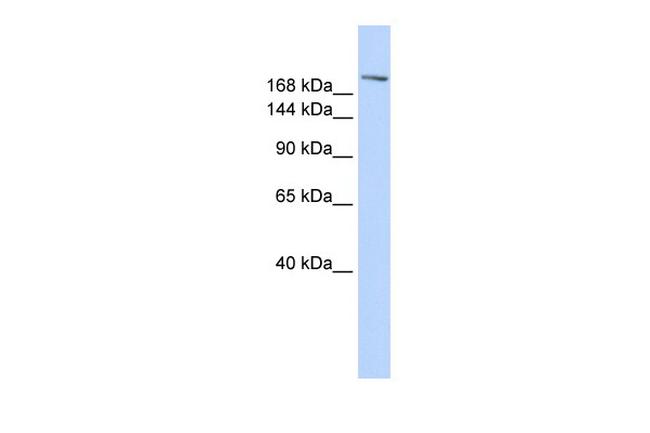 Cyclin B3 Antibody in Western Blot (WB)