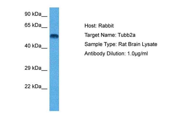 TUBB2A Antibody in Western Blot (WB)