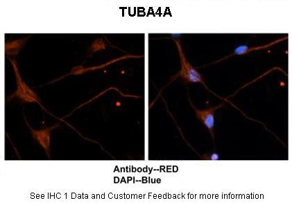 TUBA4A Antibody in Immunohistochemistry (IHC)