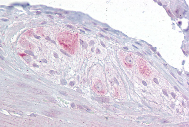 RBMS3 Antibody in Immunohistochemistry (IHC)