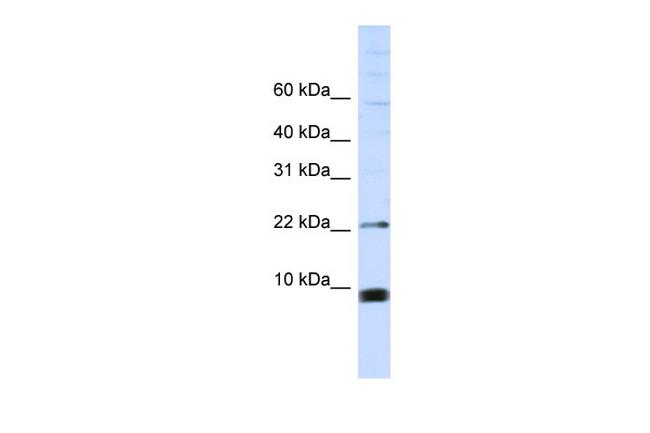SNRPF Antibody in Western Blot (WB)