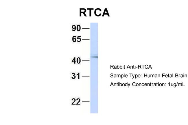 RTCA Antibody in Western Blot (WB)