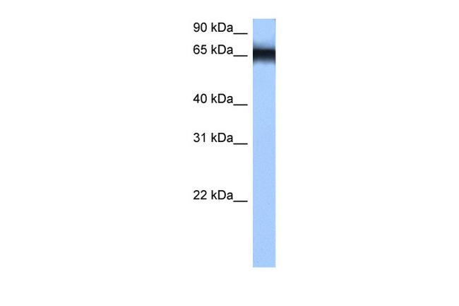 hnRNP M Antibody in Western Blot (WB)