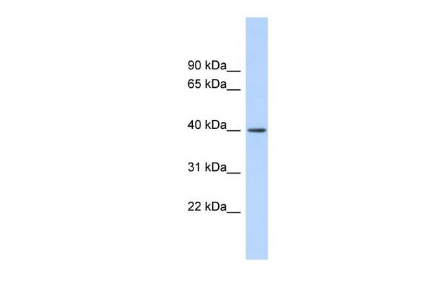 RAD51AP1 Antibody in Western Blot (WB)