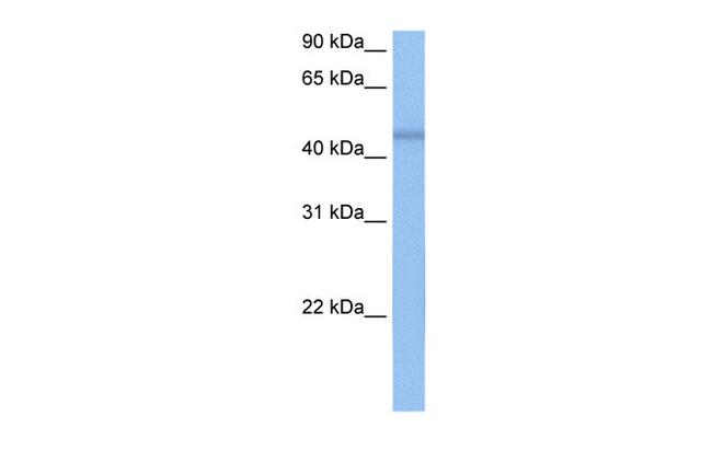 RBM48 Antibody in Western Blot (WB)