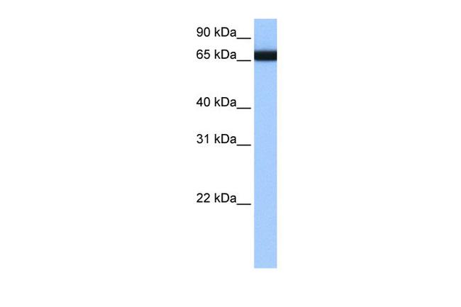 hnRNP LL Antibody in Western Blot (WB)