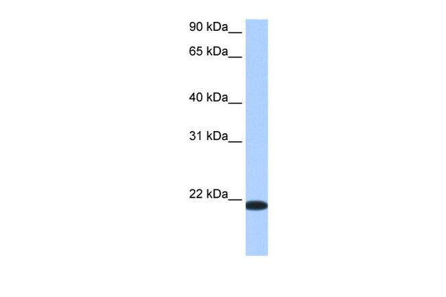 TMED4 Antibody in Western Blot (WB)