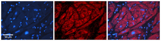 Alcohol Dehydrogenase 1B Antibody in Immunohistochemistry (Paraffin) (IHC (P))