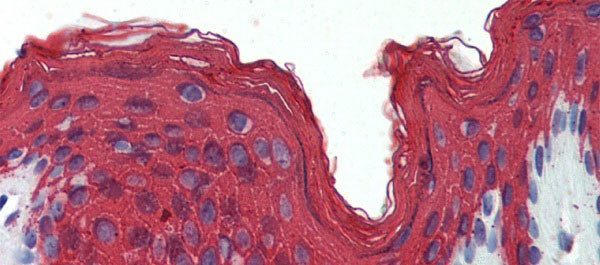 Cytokeratin 1 Antibody in Immunohistochemistry (Paraffin) (IHC (P))