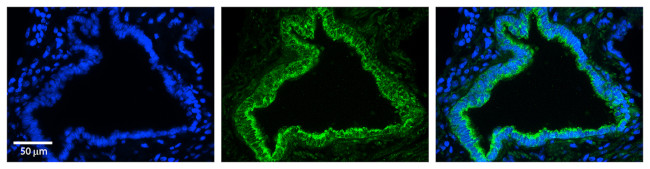RhoD Antibody in Immunohistochemistry (Paraffin) (IHC (P))