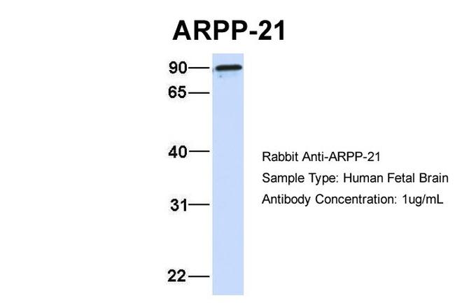 ARPP21 Antibody in Western Blot (WB)