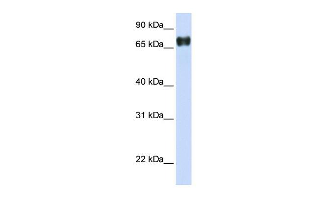 PLEKHA4 Antibody in Western Blot (WB)