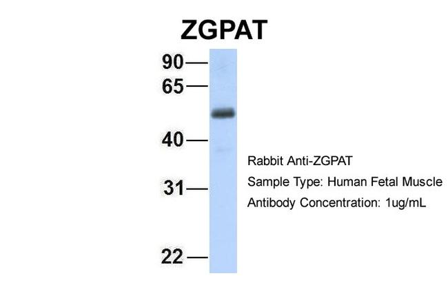 ZGPAT Antibody in Western Blot (WB)