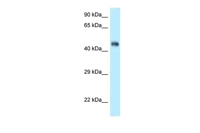 FBXL3 Antibody in Western Blot (WB)