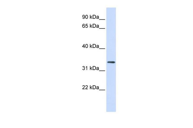 FBXO25 Antibody in Western Blot (WB)