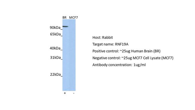 RNF19A Antibody in Western Blot (WB)