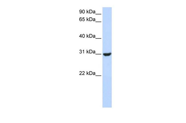 RNF182 Antibody in Western Blot (WB)