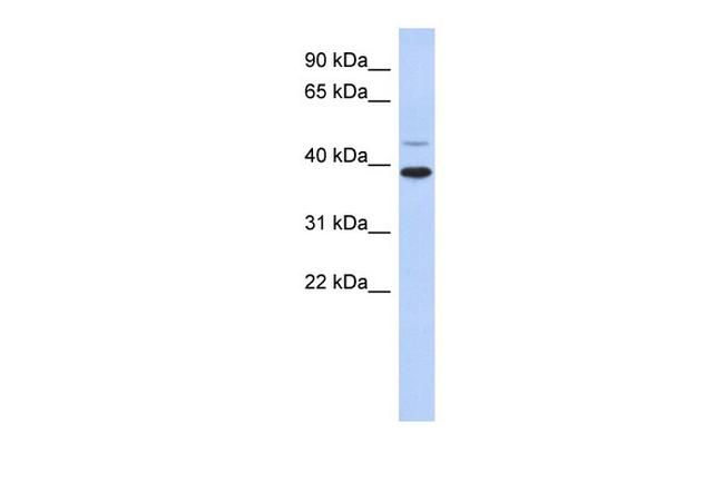 RNF121 Antibody in Western Blot (WB)