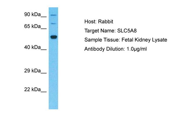 SLC5A8 Antibody in Western Blot (WB)