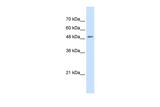 SLC43A2 Antibody in Western Blot (WB)