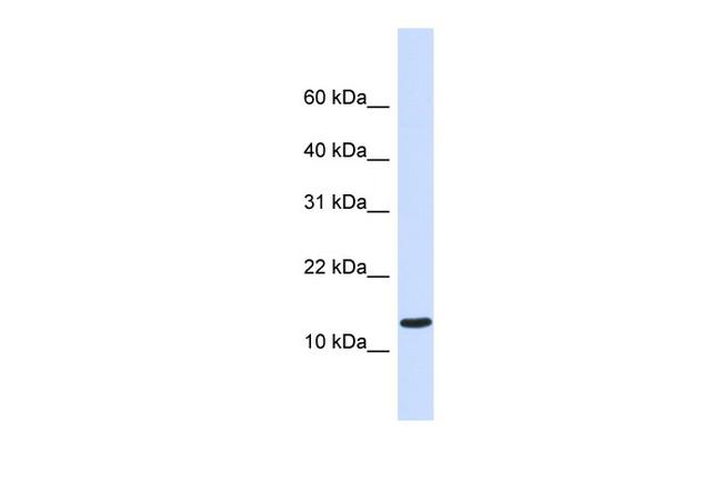 CA095 Antibody in Western Blot (WB)
