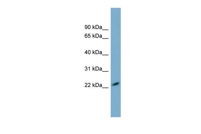 MXRA7 Antibody in Western Blot (WB)