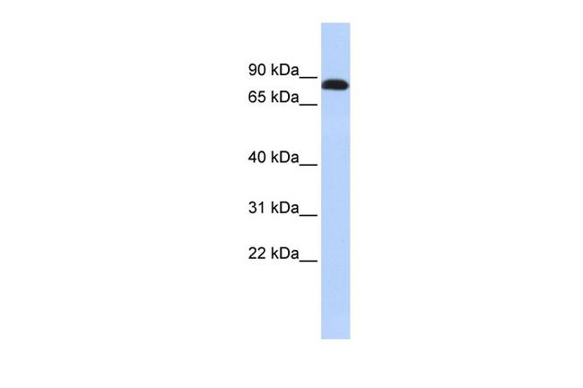 Desmocollin 3 Antibody in Western Blot (WB)