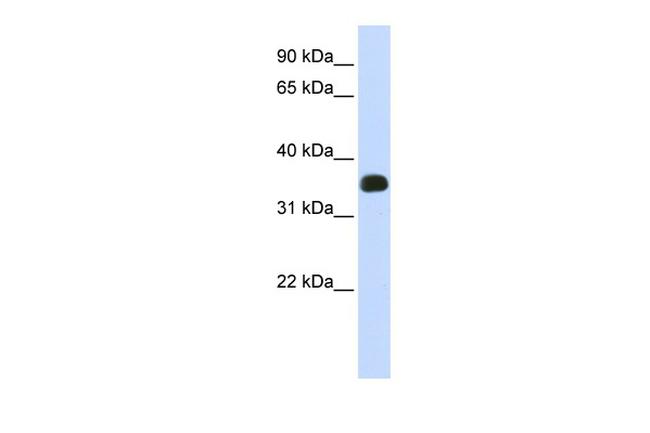 C2orf47 Antibody in Western Blot (WB)