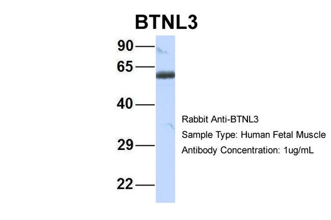 BTNL3 Antibody in Western Blot (WB)
