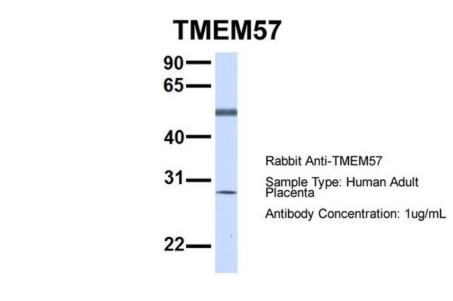 TMEM57 Antibody in Western Blot (WB)
