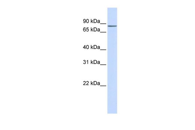 ZNF420 Antibody in Western Blot (WB)