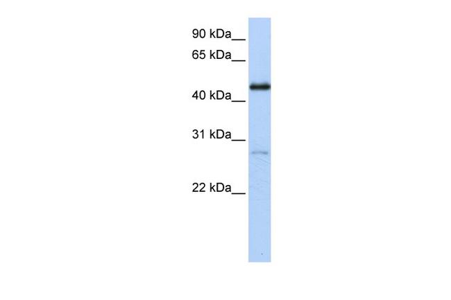 NR2F1 Antibody in Western Blot (WB)
