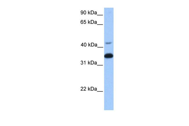 GNB2 Antibody in Western Blot (WB)