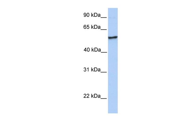 CML66 Antibody in Western Blot (WB)
